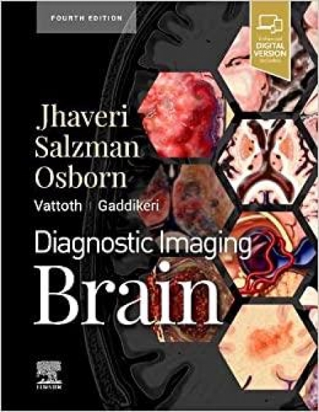 Diagnostic Imaging Brain 4th Edition