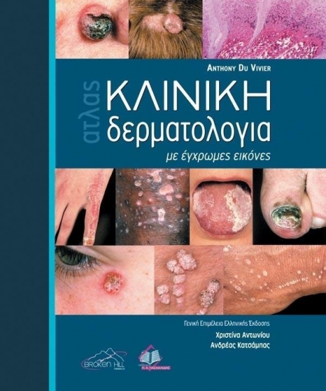 Du Vivier Άτλας  Κλινική ΔΕΡΜΑΤΟΛΟΓΙΑ με Έγχρωμες Εικόνες