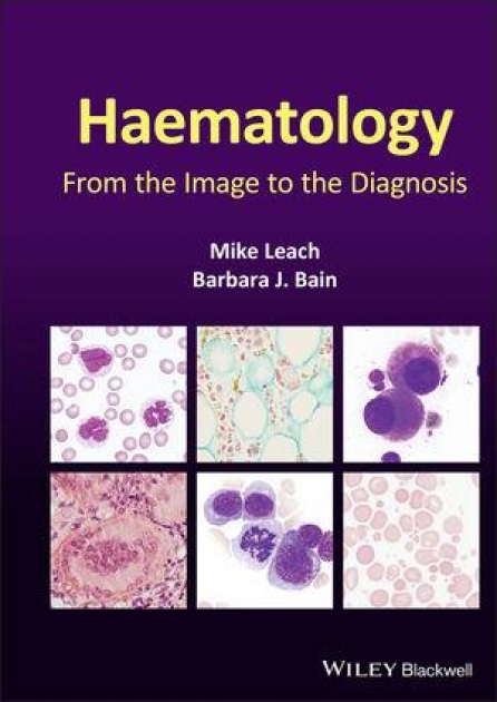 Haematology: From the Image to the Diagnosis, 1st Edition