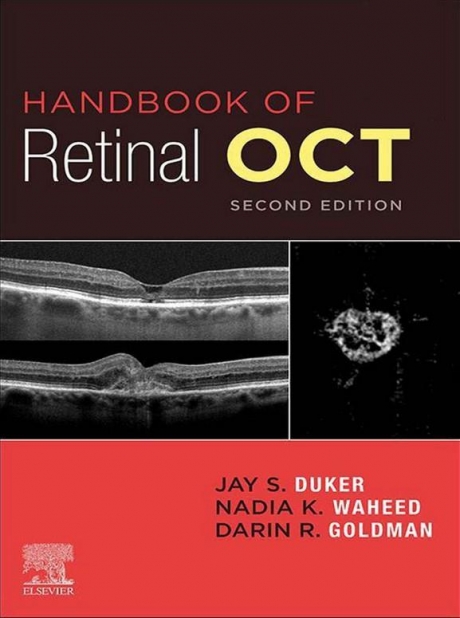 Handbook of Retinal OCT Optical Coherence Tomography, 2nd Edition