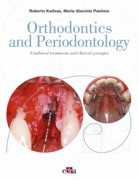 Orthodontics and Periodontology: Combined treatments and clinical synergies
