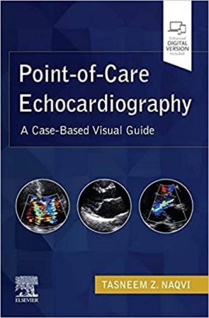 Point-of-Care Echocardiography, A Clinical Case-Based Visual Guide
