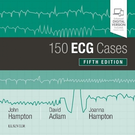 150 ECG Cases, 5th Edition