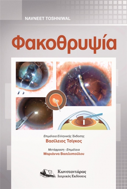 Φακοθρυψία