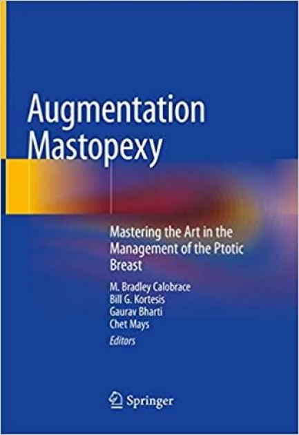 Augmentation Mastopexy