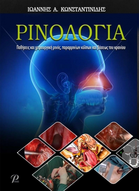 Ρινολογία: Παθήσεις και Χειρουργική Ρινός