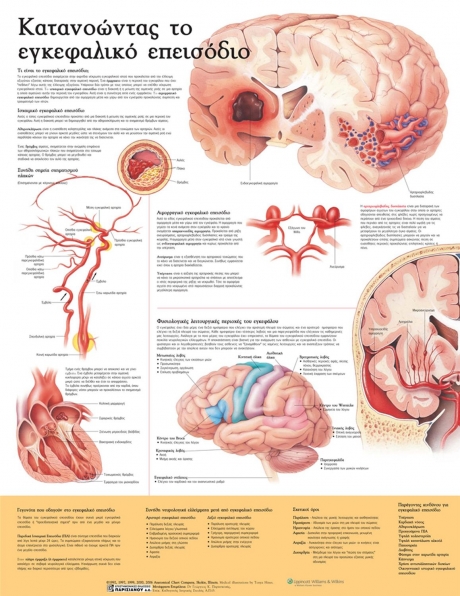 Ανατομικός Χάρτης: Κατανοώντας το Εγκεφαλικό Επεισόδιο