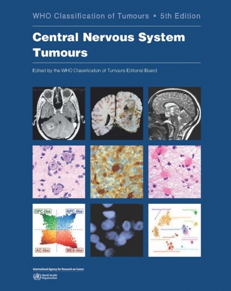 WHO Classification of Tumours of the Central Nervous System 5e 2022