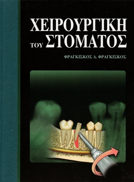 Χειρουργική του Στόματος