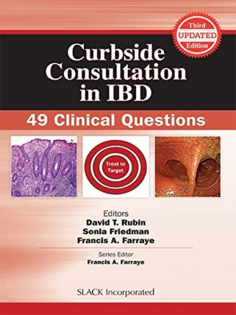 Curbside Consultation in Ibd: 49 Clinical Questions 3rd Edition