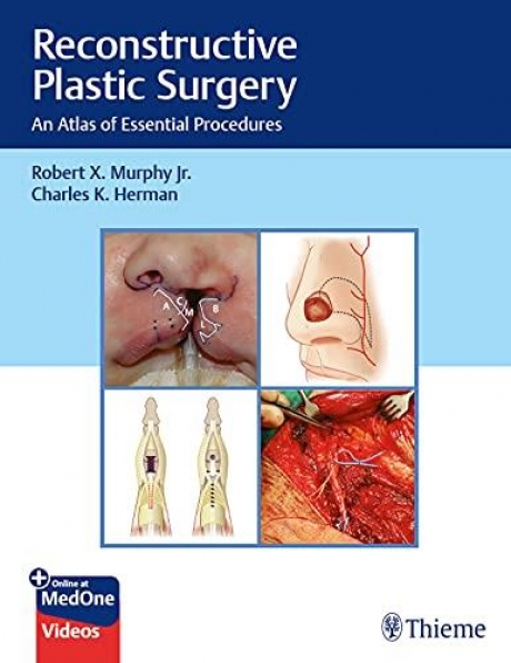 Reconstructive Plastic Surgery: An Atlas of Essential Procedures 1st Edition