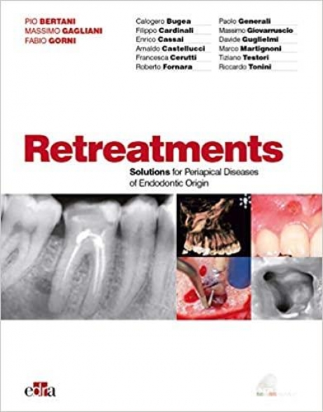 Retreatments. Solutions for apical diseases of endodontic origin