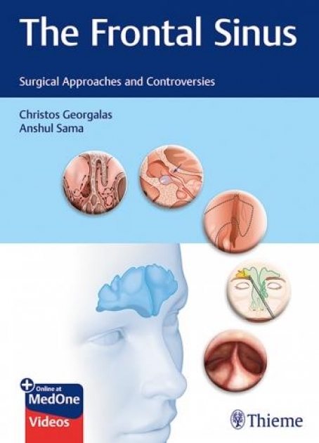 The Frontal Sinus Surgical Approaches and Controversies