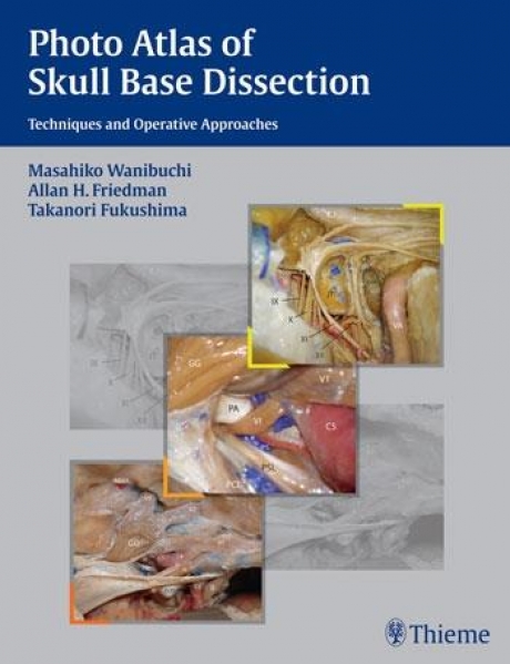 Photo Atlas of Skull Base Dissection