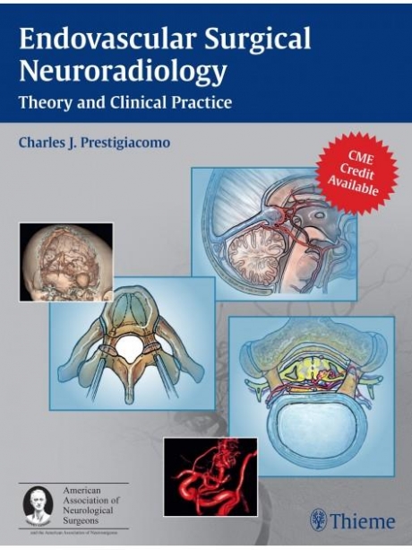 Endovascular Surgical Neuroradiology