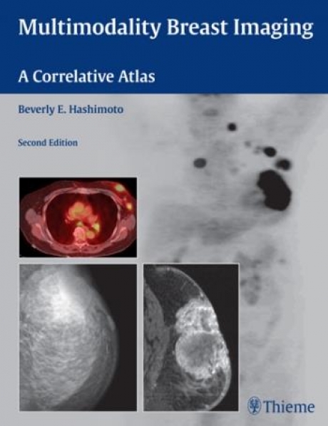 Multimodality Breast Imaging A Correlative Atlas
