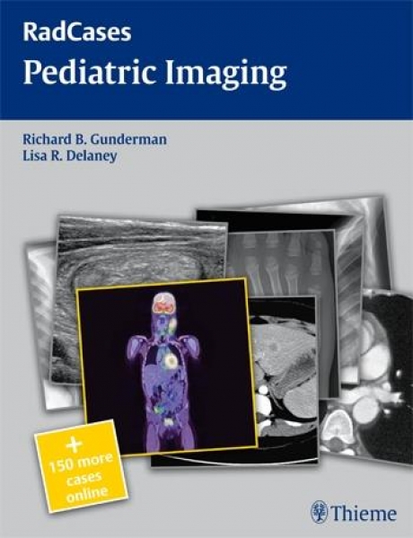 Radcases Pediatric Imaging