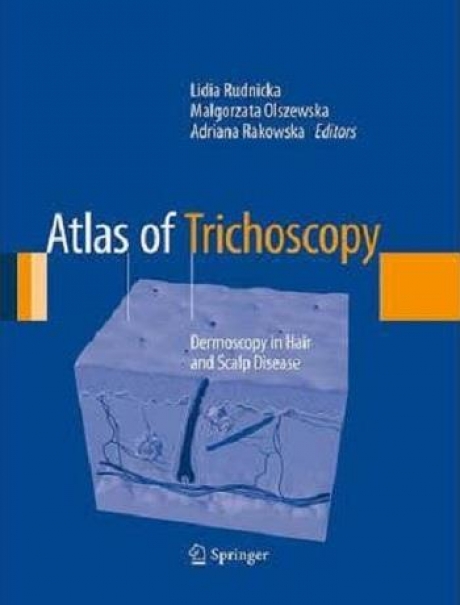 Atlas of Trichoscopy Dermoscopy in Hair and Scalp Disease