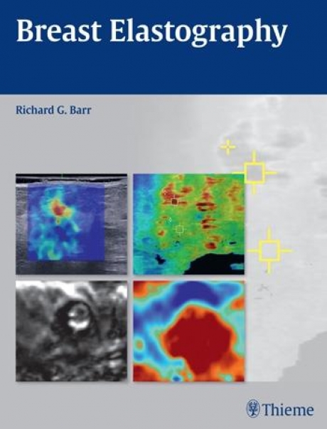 Breast Elastography, 1st Edition