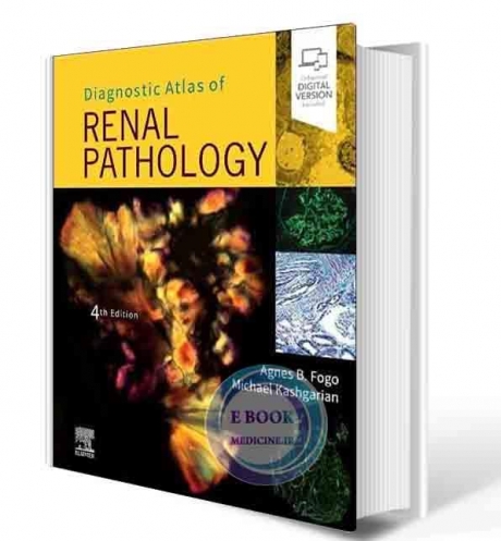 Diagnostic Atlas of Renal Pathology, 4th Edition