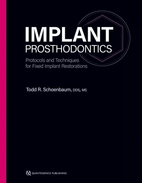 Implant Prosthodontics Protocols and Techniques for Fixed Implant Restorations