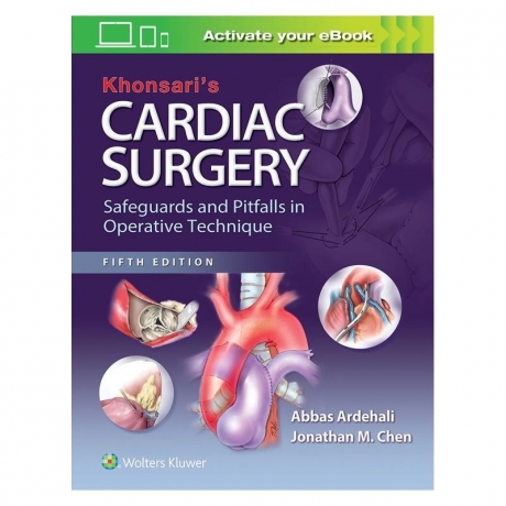 Khonsari`s Cardiac Surgery: Safeguards and Pitfalls in Operative Technique
