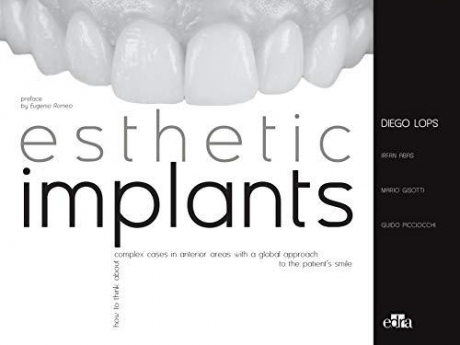 Esthetic Implants How to think about complex cases in anterior areas with a global approach to the patient smile 1st Edition