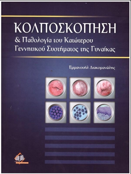 Κολποσκόπηση & Παθολογία του Κατώτερου Γεννητικού Συστήματος της Γυναίκας (Διακομανώλης)
