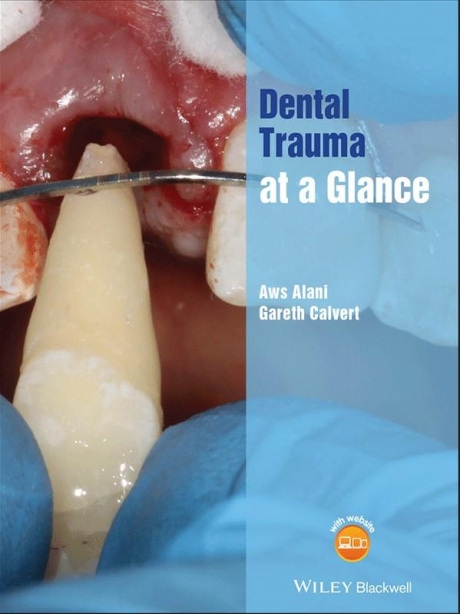 Dental Trauma at a Glance (At a Glance (Dentistry)) 1st Edition