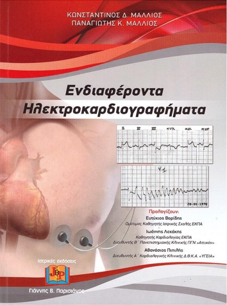 Ενδιαφέροντα Ηλεκτροκαρδιογραφήματα