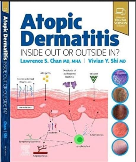 Atopic Dermatitis: Inside Out or Outside In