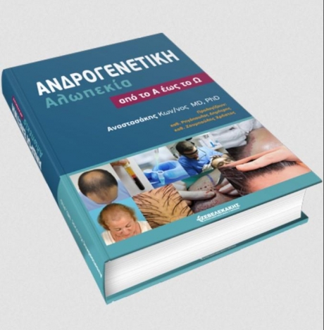 Ανδρογενετική Αλωπεκία