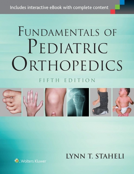 Fundamentals of Pediatric Orthopedics, 5th Edition