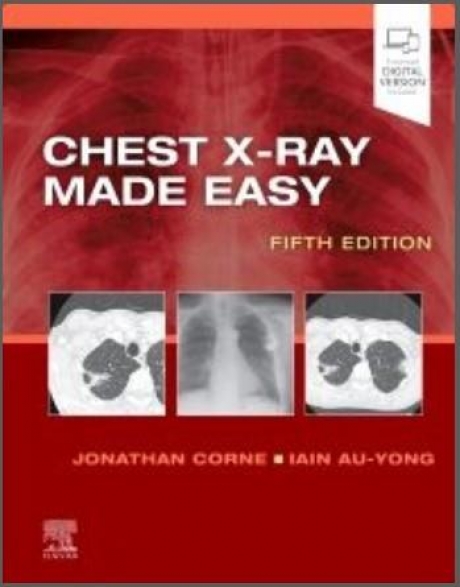 Chest X-Ray Made Easy, 5th Edition