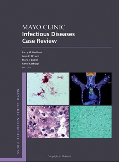Mayo Clinic Infectious Disease Case Review