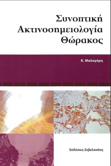 Συνοπτική Ακτινοσημειολογία Θώρακος