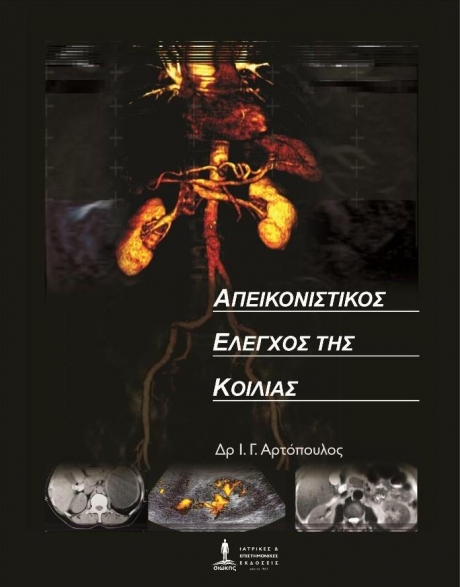 ΑΡΤΟΠΟΥΛΟΣ ΑΠΕΙΚΟΝΙΣΤΙΚΟΣ ΕΛΕΓΧΟΣ ΤΗΣ ΚΟΙΛΙΑΣ