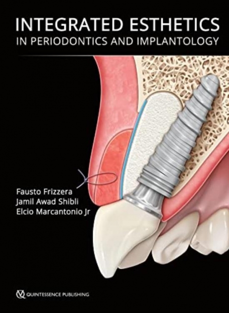 Integrated Esthetics in Periodontics and Implantology
