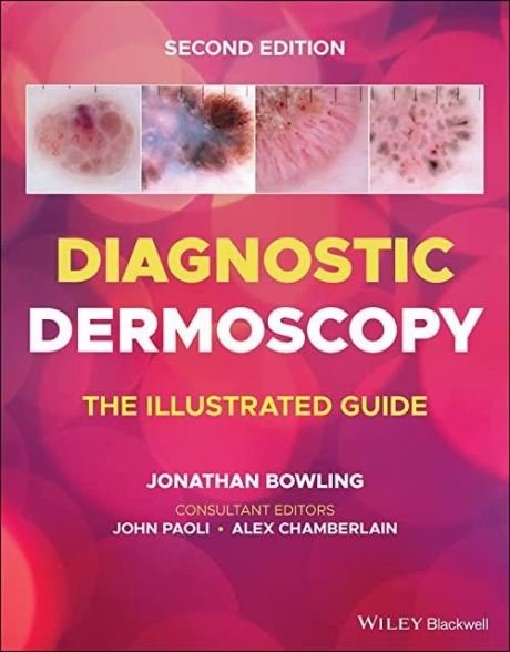 Diagnostic Dermoscopy The Illustrated Guide, 2nd Edition