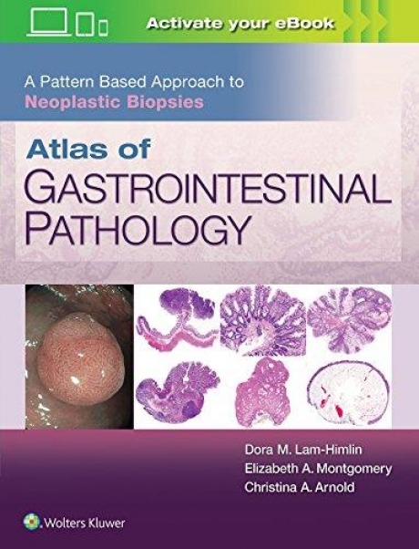Atlas of Gastrointestinal Pathology A Pattern Based Approach to Neoplastic Biopsies