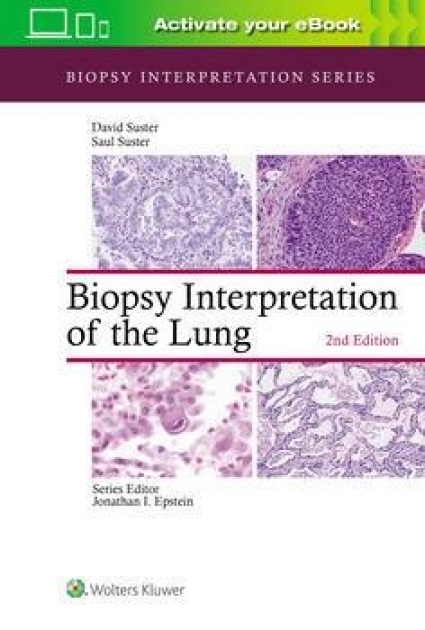 Biopsy Interpretation of the Lung, 2nd Edition