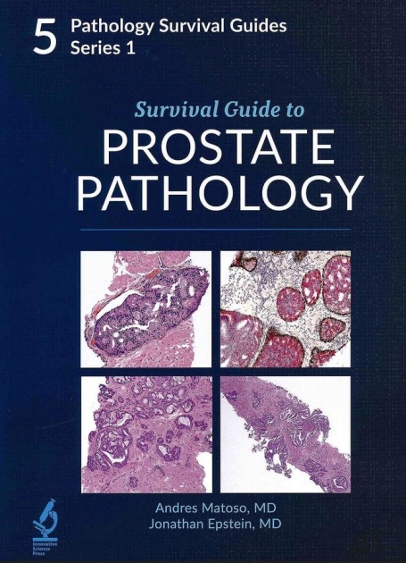 Survival Guide to Prostate Pathology