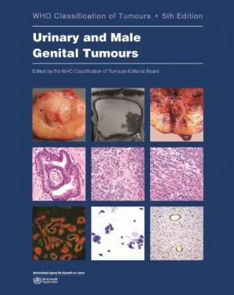 WHO Classification of Tumours Urinary and Male Genital Tumours, 5th Edition, Volume 8