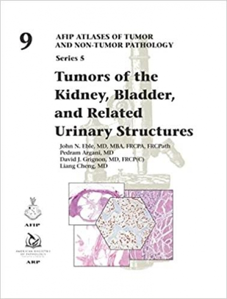 Tumors of the Kidney, Bladder, and Related Urinary Structures