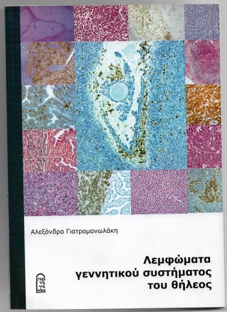 ΓΙΑΤΡΟΜΑΝΩΛΑΚΗ Λεμφώματα Γεννητικού Συστήματος του Θήλεος