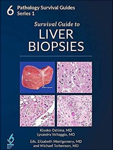Survival Guide to Liver Biopsies