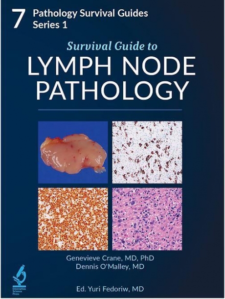 Survival Guide to Lymph Node Pathology