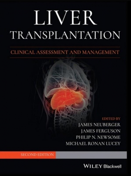 Liver Transplantation: Clinical Assessment and Management, 2nd Edition