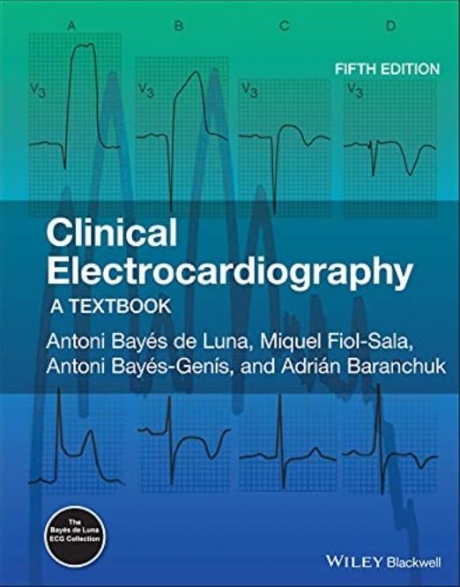 Clinical Electrocardiography: A Textbook, 5th Edition