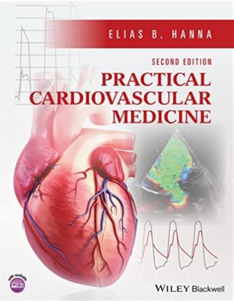 Practical Cardiovascular Medicine, 2nd Edition